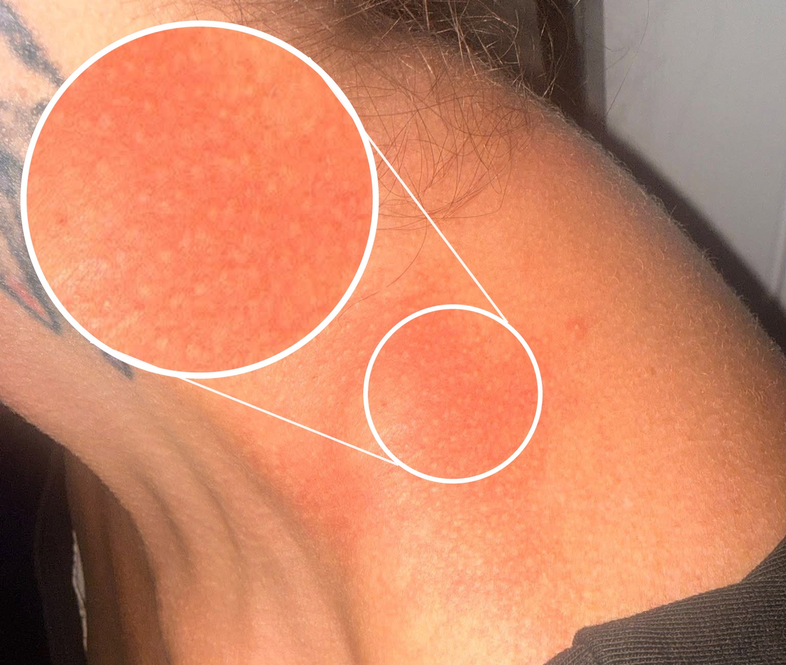 The sting the parent says she received while walking past the hedge